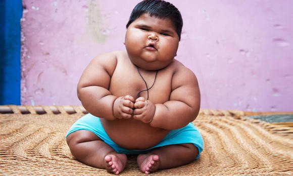 child obesity child obesity